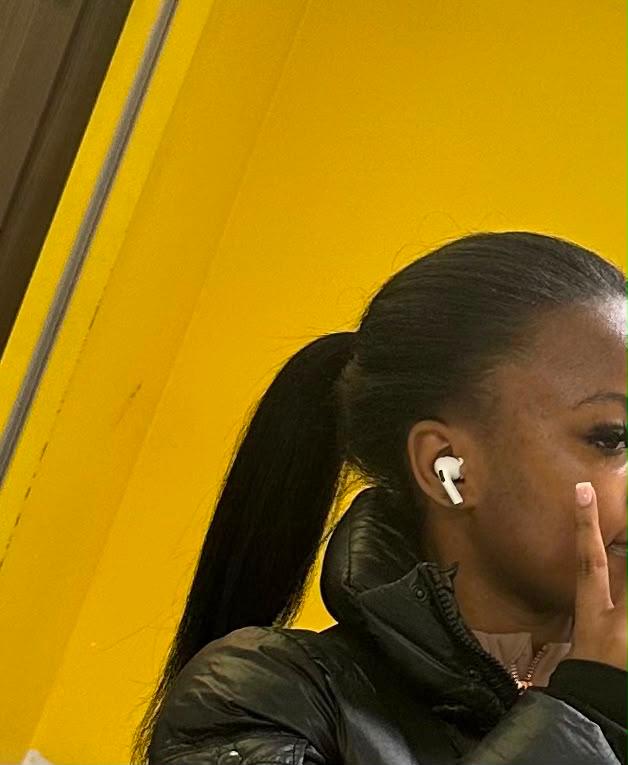 Hairline — after