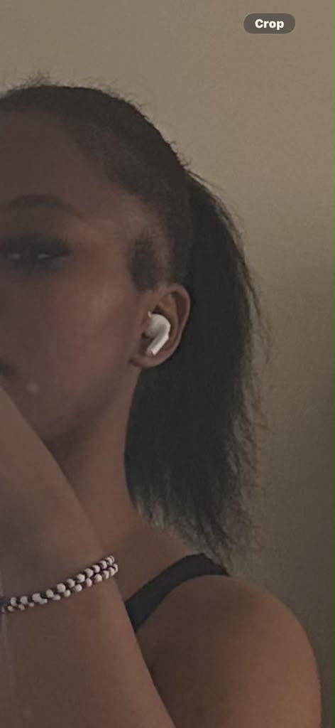 Hairline — before